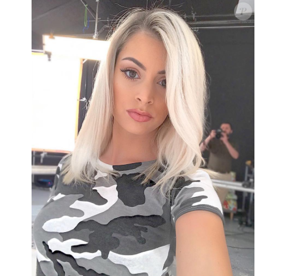Mélanie Da Cruz (Secret Story 9) est soupçonnée d'avoir eu recours à la chirurgie esthétique afin de gonfler ses lèvres.