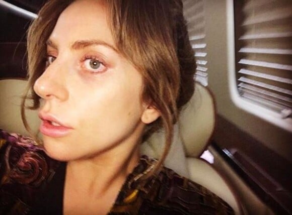 Lady Gaga méconnaissable au naturel, sans artifices ni maquillage.