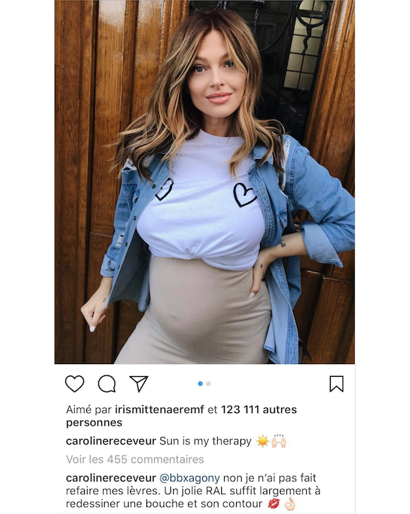 Caroline Receveur enceinte le 17 avril 2018. Non, elle n'a pas fait refaire ses lèvres !