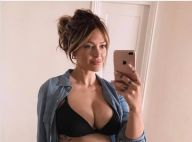 Caroline Receveur, les rumeurs de chirurgie esthétique : "Je vais tout avouer"