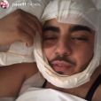 Jaja de "Secret Story 10" en Tunisie pour des opérations de chirurgie esthétique - Snapchat, mai 2018