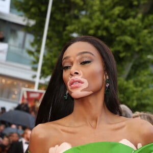 Winnie Harlow (bijoux De Grisogono) - Montée des marches du film « Blackkklansman » lors du 71ème Festival International du Film de Cannes. Le 14 mai 2018 © Borde-Jacovides-Moreau/Bestimage