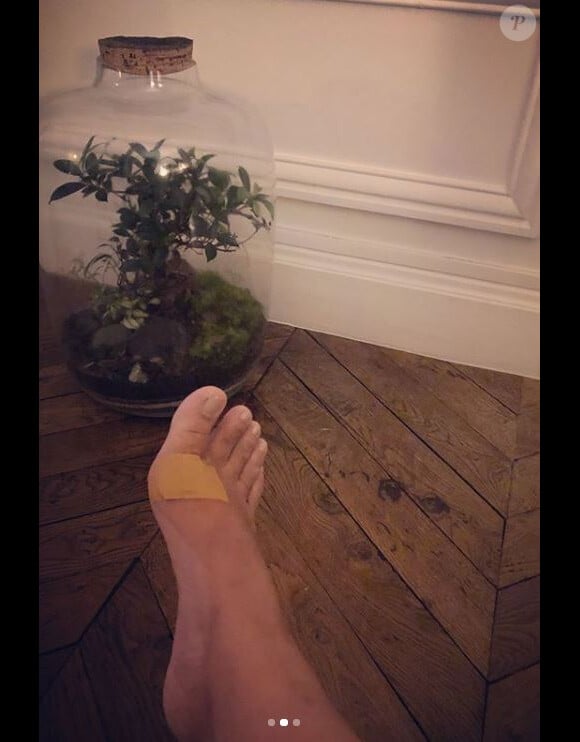 Anggun a partagé des photos d'elle, après une blessure, sur Instagram, le 24 octobre 2018