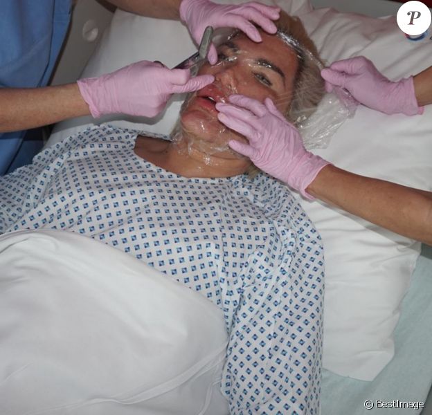 Rodrigo Alves alias "Human Ken Doll" lors d'une opération chirurgicale du visage au centre Medico Beauty & IVF de Prague, République tchèque, le 3 mai 2018.