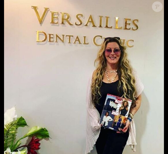Loana dévoile ses nouvelles dents - Instagram, 7 janvier 2019