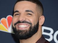 Drake accusé d'avoir fait de la chirurgie esthétique : il répond aux rumeurs