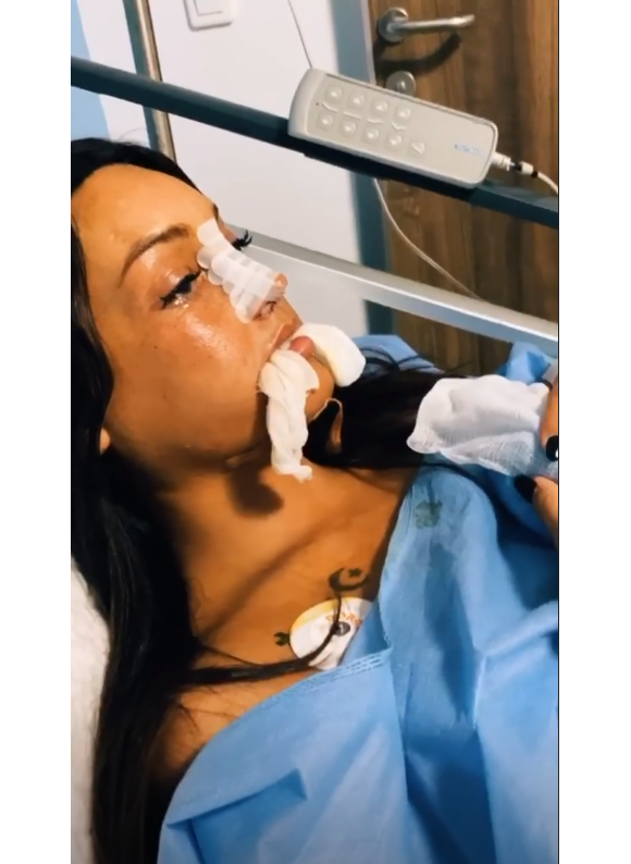 Aurélie Dotremont après sa nouvelle opération chirurgicale, sur Instagram les 16 et 17 octobre 2019.
