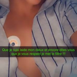 Aurélie Dotremont après sa nouvelle opération chirurgicale, sur Instagram les 16 et 17 octobre 2019.