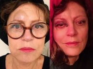 Susan Sarandon : Très amochée, le nez cassé, elle lance un appel d'urgence