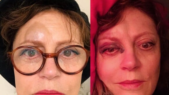 Susan Sarandon : Très amochée, le nez cassé, elle lance un appel d'urgence