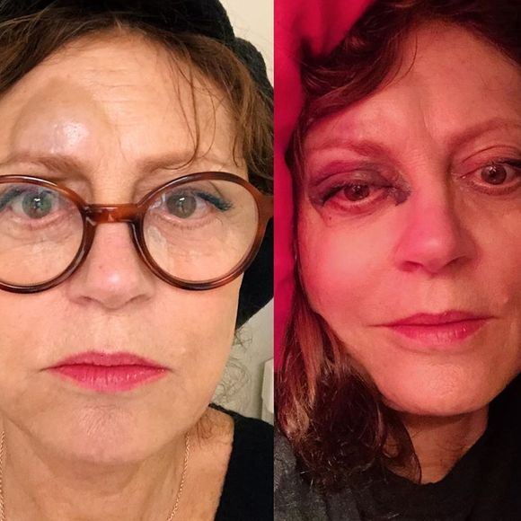 Susan Sarandon a été victime d'une mauvaise chute et a dû renoncer à se déplacer dans le New Hampshire avec le sénateur Bernie Sanders, mais son nez cassé ne l'a pas empêchée de passer un puissant message à ses abonnés sur Instagram le 22 novembre 2019.