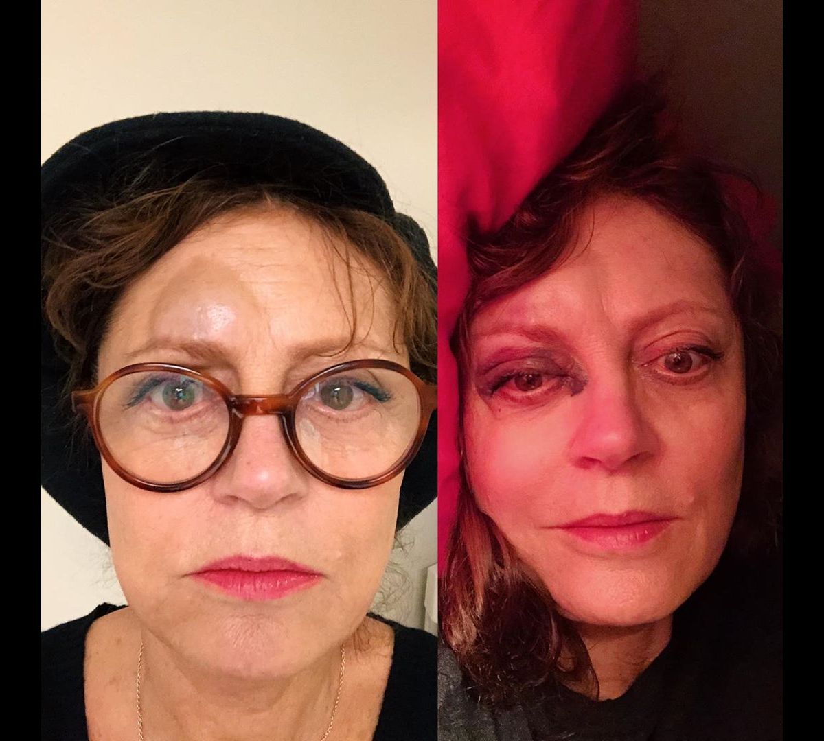 Susan Sarandon Tres Amochee Le Nez Casse Elle Lance Un Appel D Urgence Purepeople