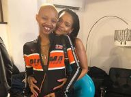 Slick Woods : La chouchoute de Rihanna, défigurée après une crise