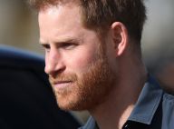 Prince Harry : Des implants capillaires très coûteux pour faire plaisir à Meghan