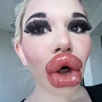 Andrea Ivanova : Lèvres XXL, chirurgie, la Bulgare de 22 ans en veut encore plus