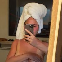 Chrissy Teigen : Topless pour exhiber son méga coup de soleil