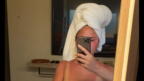 Chrissy Teigen : Topless pour exhiber son méga coup de soleil
