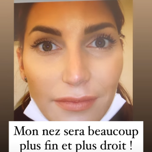 Nadège Lacroix fait une nouvelle rhinoplastie, le 8 décembre 2020