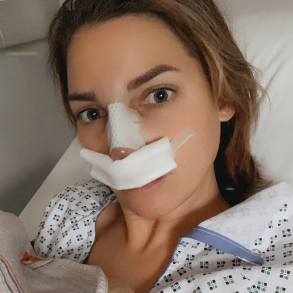 Nadège Lacroix fait une nouvelle rhinoplastie, le 8 décembre 2020