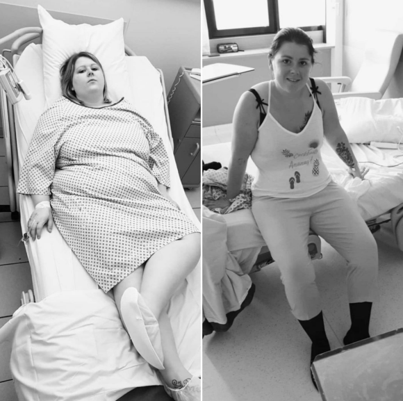 Stacy, participante à "Opération renaissance" qui suit les interventions chirurgicales d'obésité sur M6.