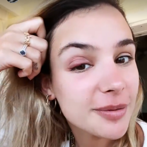 Jade Leboeuf en vacances à Saint-Barthélémy souffre d'une infection à l'oeil - Instagram