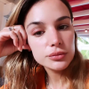 Jade Leboeuf dévoile son oeil très gonflé sur Instagram - 14 janvier 2021