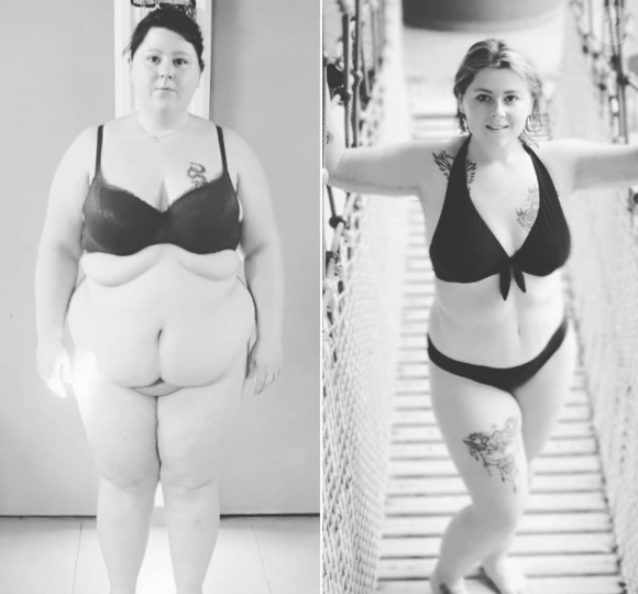 Stacy a perdu plus de 50 kilos après son passage dans l'émission "Opération renaissance".
