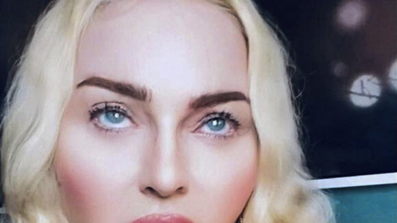 Madonna de plus en plus figée : la peau ultra-lisse de la chanteuse éblouit ses fans