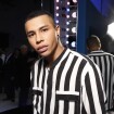 Olivier Rousteing brûlé après un grave accident : photo choc et révélations tardives