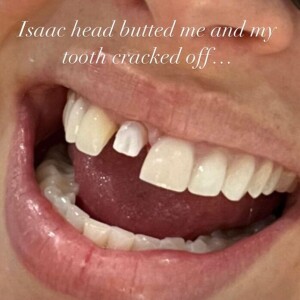 La mannequin Ashley Graham dévoile sa dent, après que son fils lui ait donné un coup.