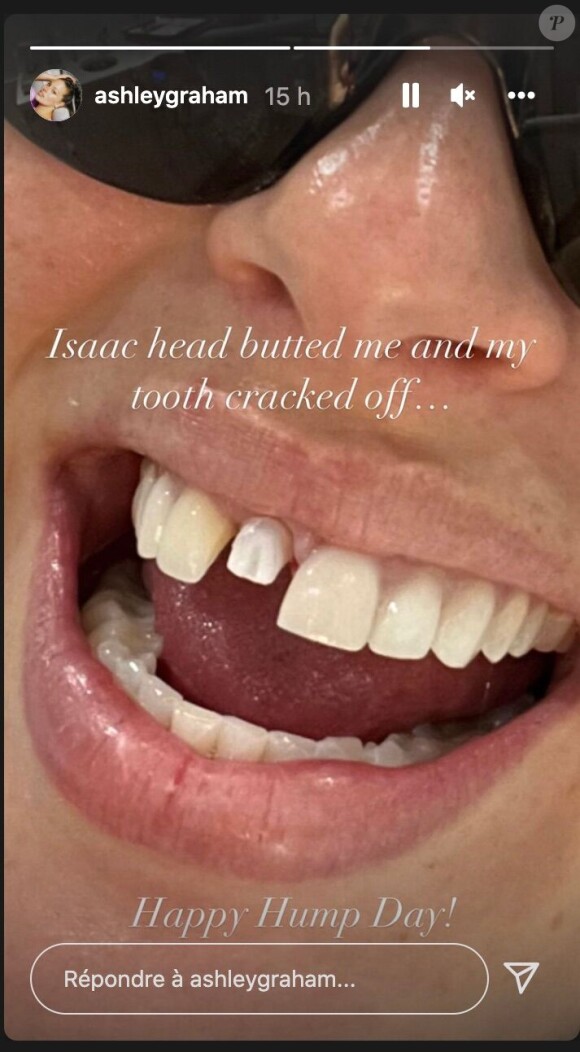 La mannequin Ashley Graham dévoile sa dent, après que son fils lui ait donné un coup.