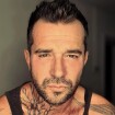 Mathieu (L'amour est dans le pré) attaqué par les punaises de lit : photo impressionnante de son corps recouvert de piqûres