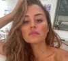 Elle est apparue le visage tuméfié
Anaïs Camizuli pose sur Instagram