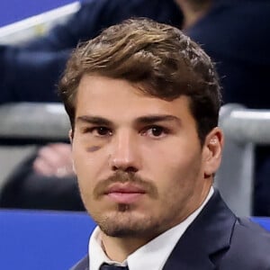 Antoine Dupont sèchement recadré
 
Antoine Dupont - Femmes de joueurs et joies à l'issue du match de Coupe du monde de rugby entre la France et l'Italie à Lyon. © Cyril Moreau-Dominique Jacovides/Bestimage