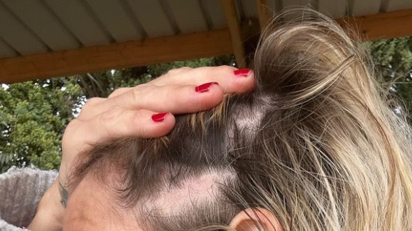 "J'ai des trous..." : Une candidate de Familles nombreuses s'alarme face à la perte de ses cheveux