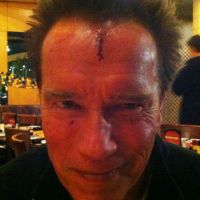 Arnold Schwarzenegger se blesse sérieusement