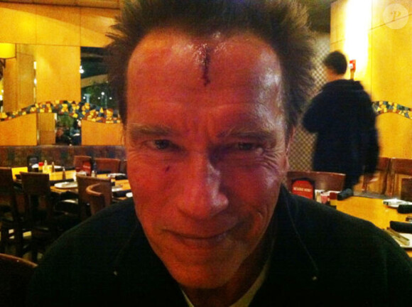 Arnold Schwarzenegger a tweeté son autoportrait où l'on constate la blessure qu'il a subi sur le tournage de The Last Stand en novembre 2011