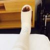 La jambe blessée du joueur du Nigeria Ogenyi Onazi après le terrible tacle de Blaise Matuidi lors de la Coupe du monde au Brésil le 30 juin 2014.