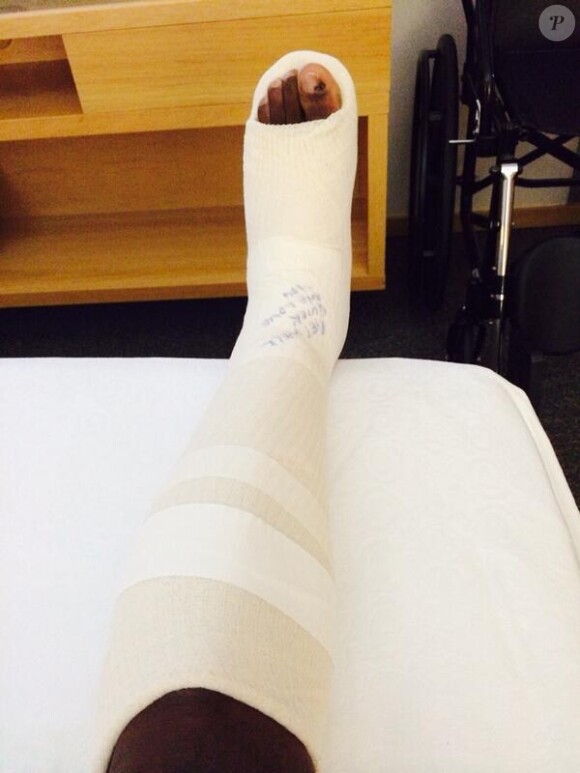 La jambe blessée du joueur du Nigeria Ogenyi Onazi après le terrible tacle de Blaise Matuidi lors de la Coupe du monde au Brésil le 30 juin 2014.