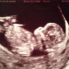 Kelly Stables a publié un cliché de son échographie sur Facebook, le 7 octobre 2014