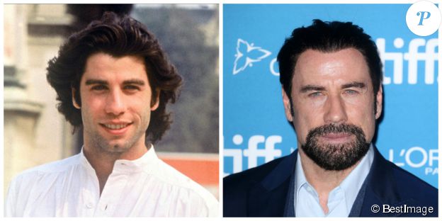John Travolta en 1978 et en 2014. ©BESTIMAGE