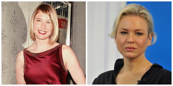 Renée Zellweger en septembre 2000 et en octobre 2014. ©Abaca Press