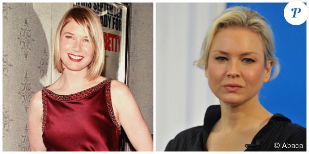 Renée Zellweger en septembre 2000 et en octobre 2014. ©Abaca Press