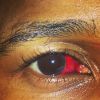 Usher a posté une photo de son oeil blessé après une bagarre qui a lieu pour la soirée du 31 décembre, le chanteur a posté cette photo sur son compte Instagram le 2 janvier 2015.