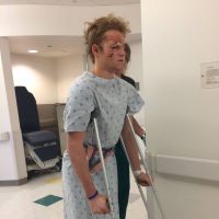 Dalton Gray (American Horror Story) : Hospitalisé après un grave accident !