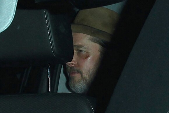 Brad Pitt sort d'un dîner au restaurant Giorgio Baldi à Santa Monica, Los Angeles, le 28 avril 2015. On peut notamment apercevoir sa blessure au visage.