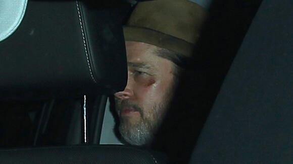 Brad Pitt, amoché au visage : Un dîner sans Angie pour se réconforter