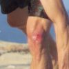 Exclusif - Danny (Daniel) Moder profite de la plage et fait du body surf - il s'est un peu blessé - lors d'une escapade avec sa femme Julia Roberts à Cabo San Lucas, le 22 juin 2015.