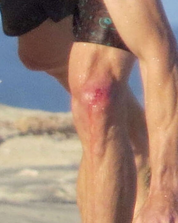 Exclusif - Danny (Daniel) Moder profite de la plage et fait du body surf - il s'est un peu blessé - lors d'une escapade avec sa femme Julia Roberts à Cabo San Lucas, le 22 juin 2015.