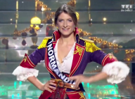 Miss France 2016 - Miss Normandie lynchée sur Twitter : Ses pires sosies !
